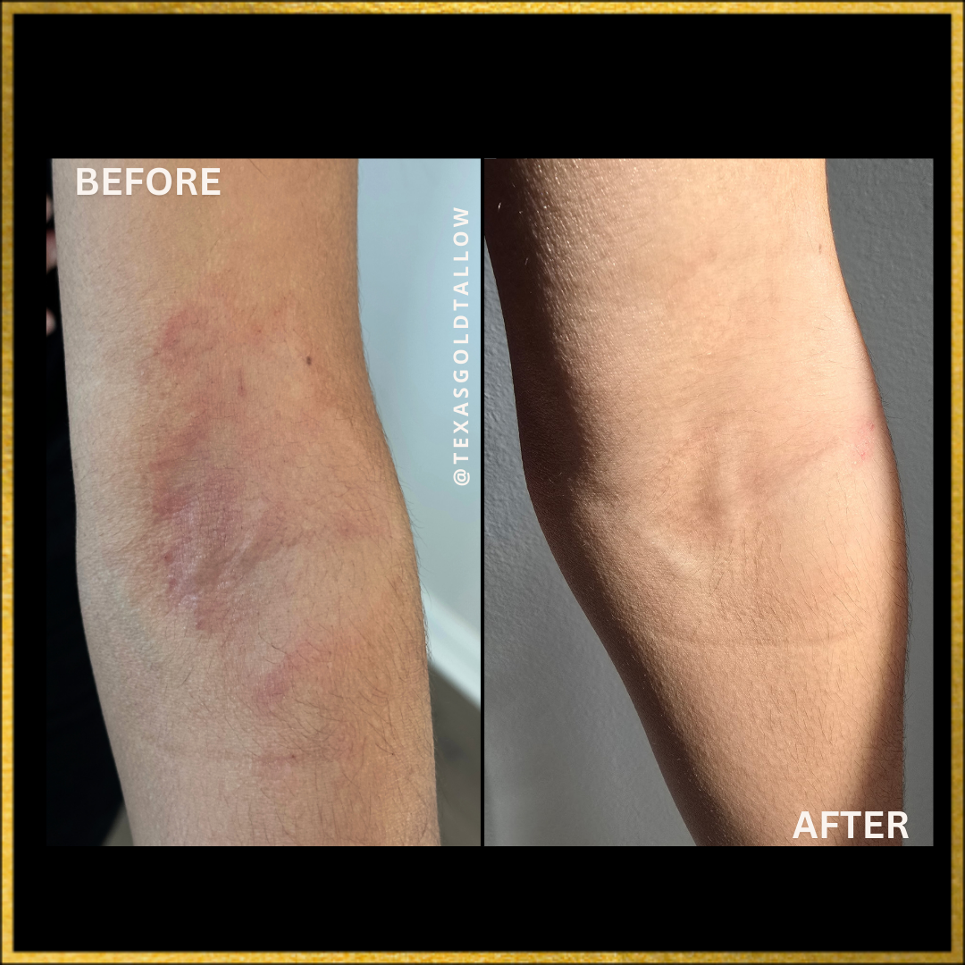 Texas Gold Tallow before and after customer testimonial best tallow in the United States